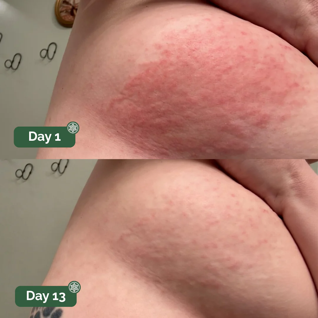 Auvra™ Antifungal Soap