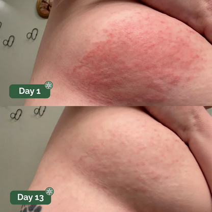 Auvra™ Antifungal Soap