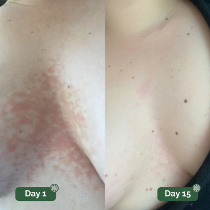 Auvra™ Antifungal Soap