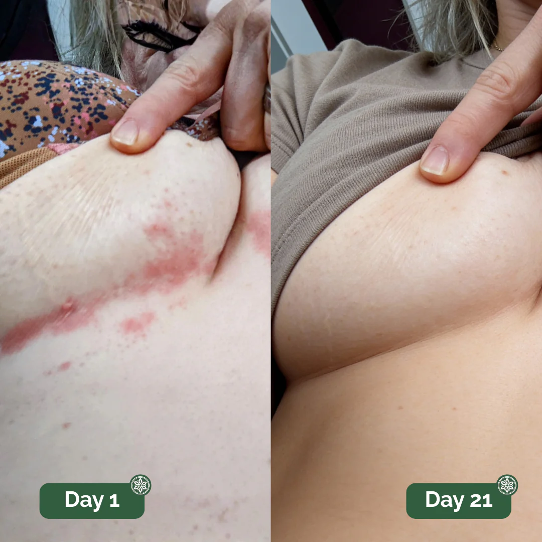 Auvra™ Antifungal Soap